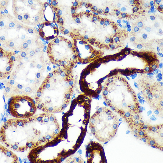 EML4 Rabbit Polyclonal Antibody - Image 3