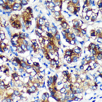 EML4 Rabbit Polyclonal Antibody - Image 4