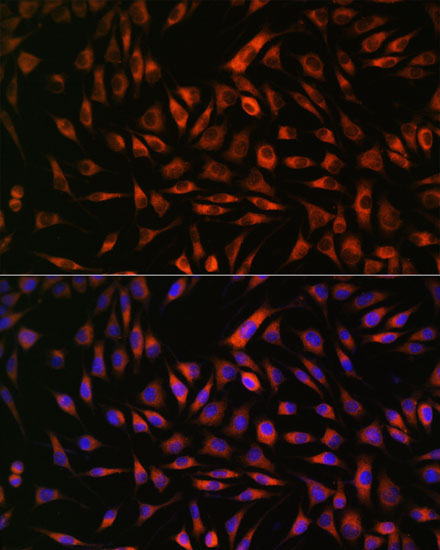 EML4 Rabbit Polyclonal Antibody - Image 5