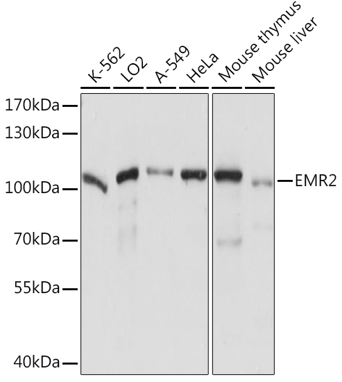 EMR2 Rabbit Polyclonal Antibody