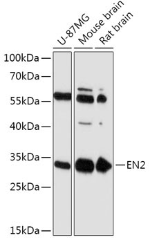 EN2 Rabbit Polyclonal Antibody