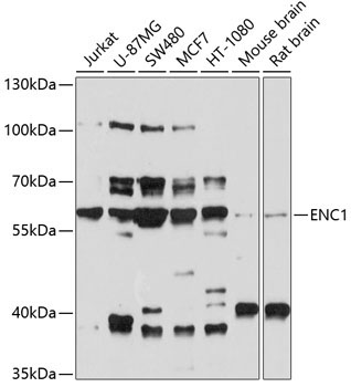 ENC1 Rabbit Polyclonal Antibody