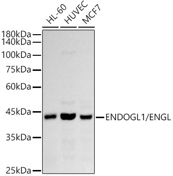 ENDOGL1 / ENGL Rabbit Monoclonal Antibody