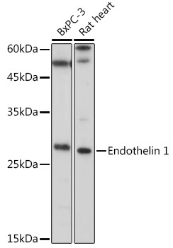 Endothelin 1 Rabbit Polyclonal Antibody
