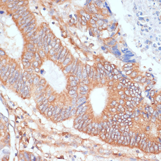 ENO1 Rabbit Polyclonal Antibody - Image 2