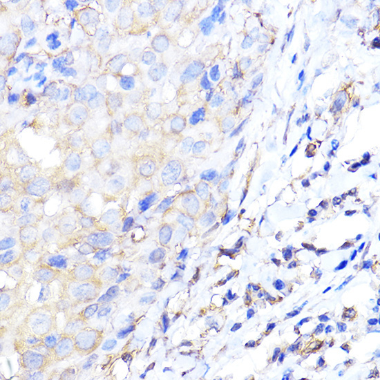ENO1 Rabbit Polyclonal Antibody - Image 3