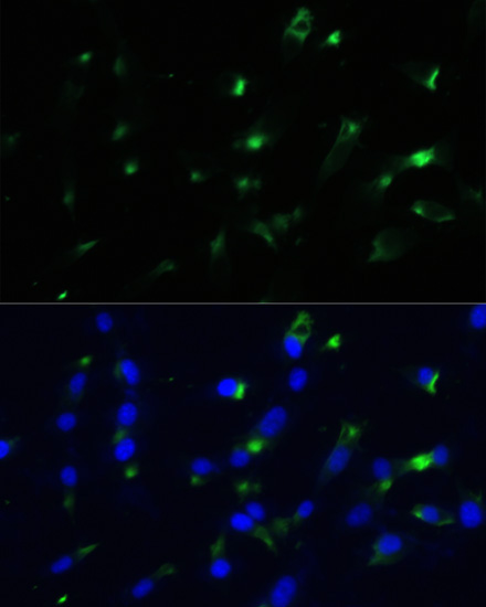 ENO1 Rabbit Polyclonal Antibody - Image 4