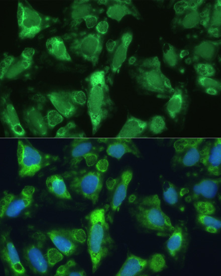 ENO1 Rabbit Polyclonal Antibody - Image 5