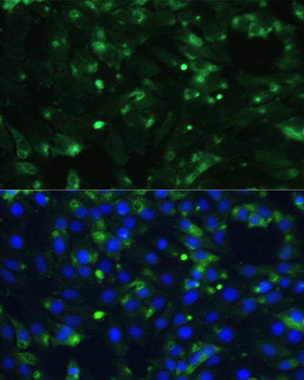 ENO1 Rabbit Polyclonal Antibody - Image 2