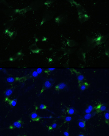 ENO1 Rabbit Polyclonal Antibody - Image 3