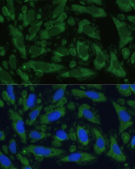 ENO1 Rabbit Polyclonal Antibody - Image 4