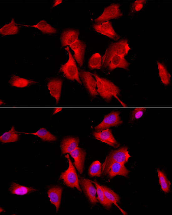 ENO2 Rabbit Polyclonal Antibody - Image 2