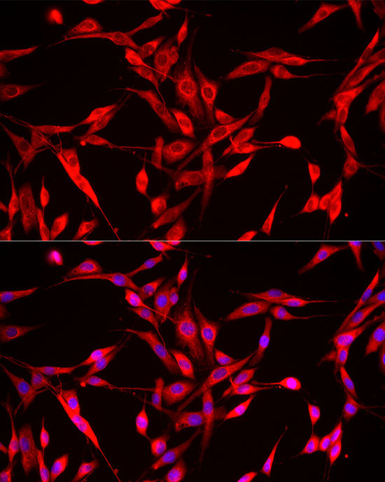 ENO2 Rabbit Polyclonal Antibody - Image 3