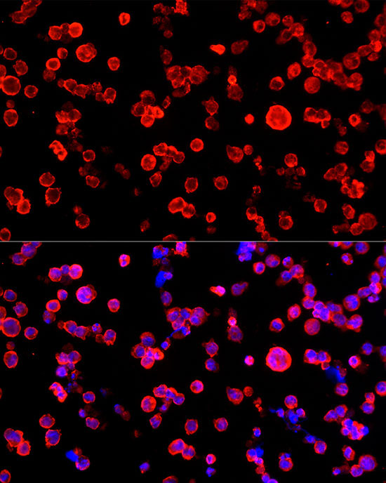 ENO2 Rabbit Polyclonal Antibody - Image 4