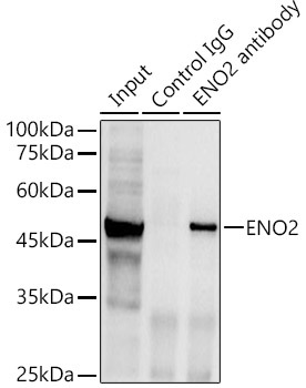ENO2 Rabbit Polyclonal Antibody - Image 5