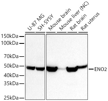ENO2 Rabbit Polyclonal Antibody