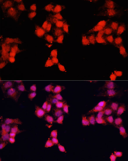 ENO3 Rabbit Polyclonal Antibody - Image 2
