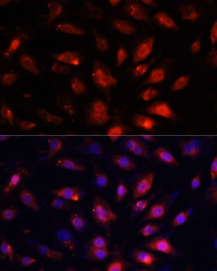 ENO3 Rabbit Polyclonal Antibody - Image 3