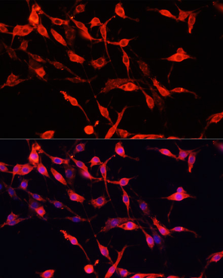 ENO3 Rabbit Polyclonal Antibody - Image 4