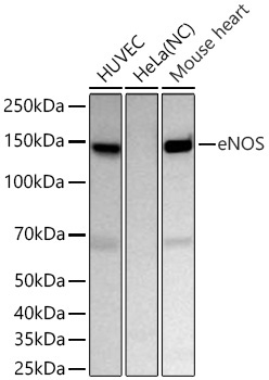 eNOS Rabbit Monoclonal Antibody