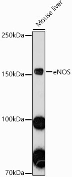 eNOS Rabbit Polyclonal Antibody - Image 2