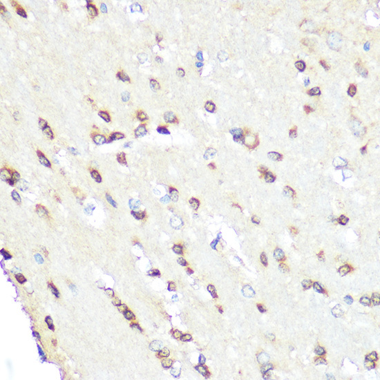 eNOS Rabbit Polyclonal Antibody - Image 3