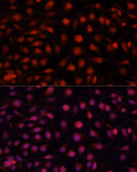 eNOS Rabbit Polyclonal Antibody - Image 4
