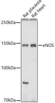 eNOS Rabbit Polyclonal Antibody
