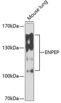 ENPEP Rabbit Polyclonal Antibody
