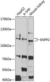 ENPP2 Rabbit Polyclonal Antibody