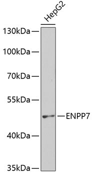 ENPP7 Rabbit Polyclonal Antibody