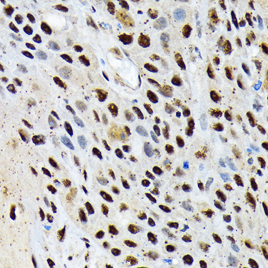 ENT2/SLC29A2 Rabbit Monoclonal Antibody