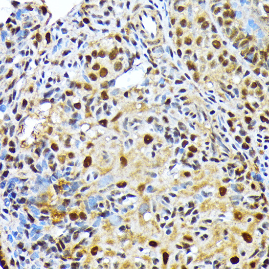 ENT2/SLC29A2 Rabbit Monoclonal Antibody - Image 2