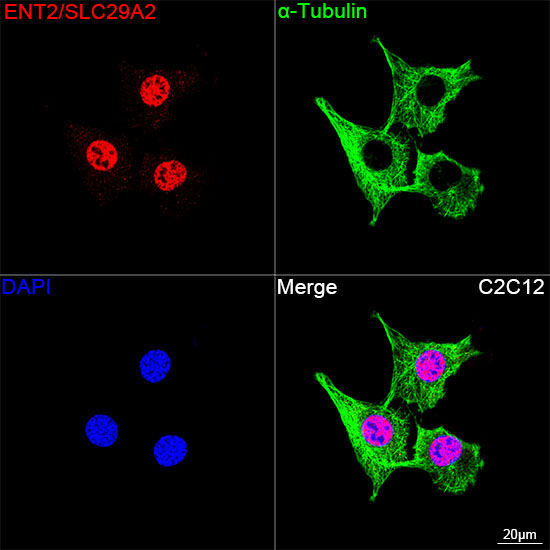 ENT2/SLC29A2 Rabbit Monoclonal Antibody - Image 3