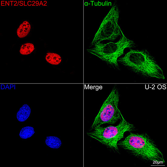 ENT2/SLC29A2 Rabbit Monoclonal Antibody - Image 4