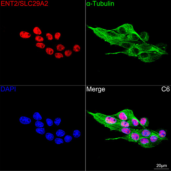 ENT2/SLC29A2 Rabbit Monoclonal Antibody - Image 5