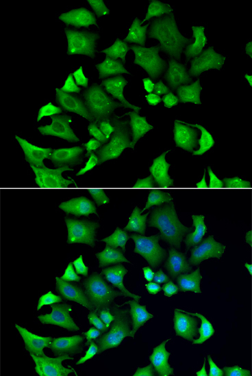 ENTPD2 Rabbit Polyclonal Antibody