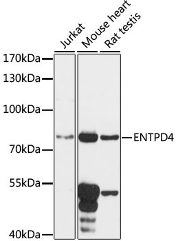 ENTPD4 Rabbit Polyclonal Antibody