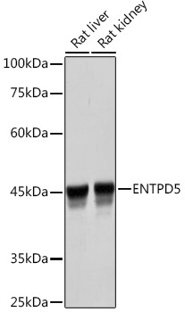 ENTPD5 Rabbit Monoclonal Antibody