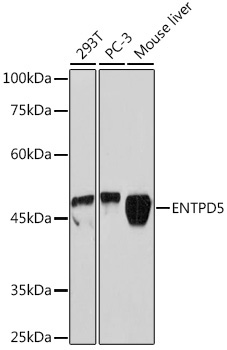 ENTPD5 Rabbit Monoclonal Antibody - Image 2