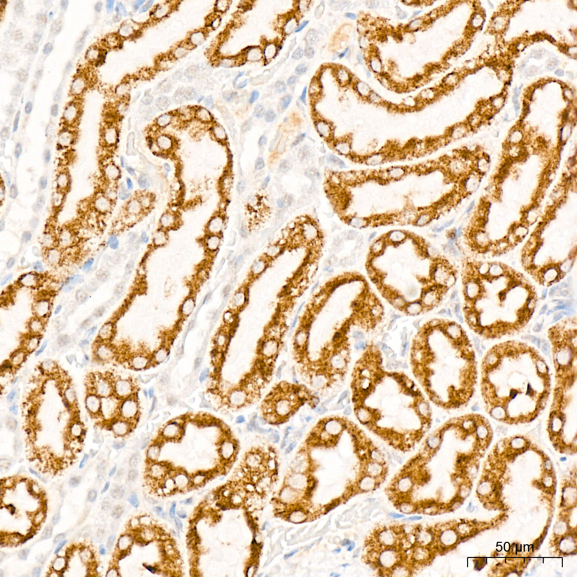 ENTPD5 Rabbit Monoclonal Antibody - Image 3