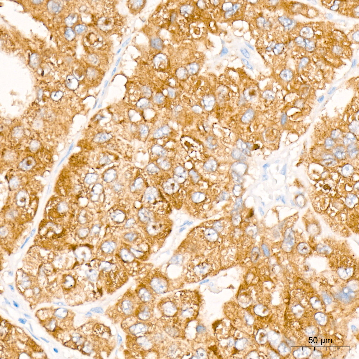 ENTPD5 Rabbit Monoclonal Antibody - Image 4
