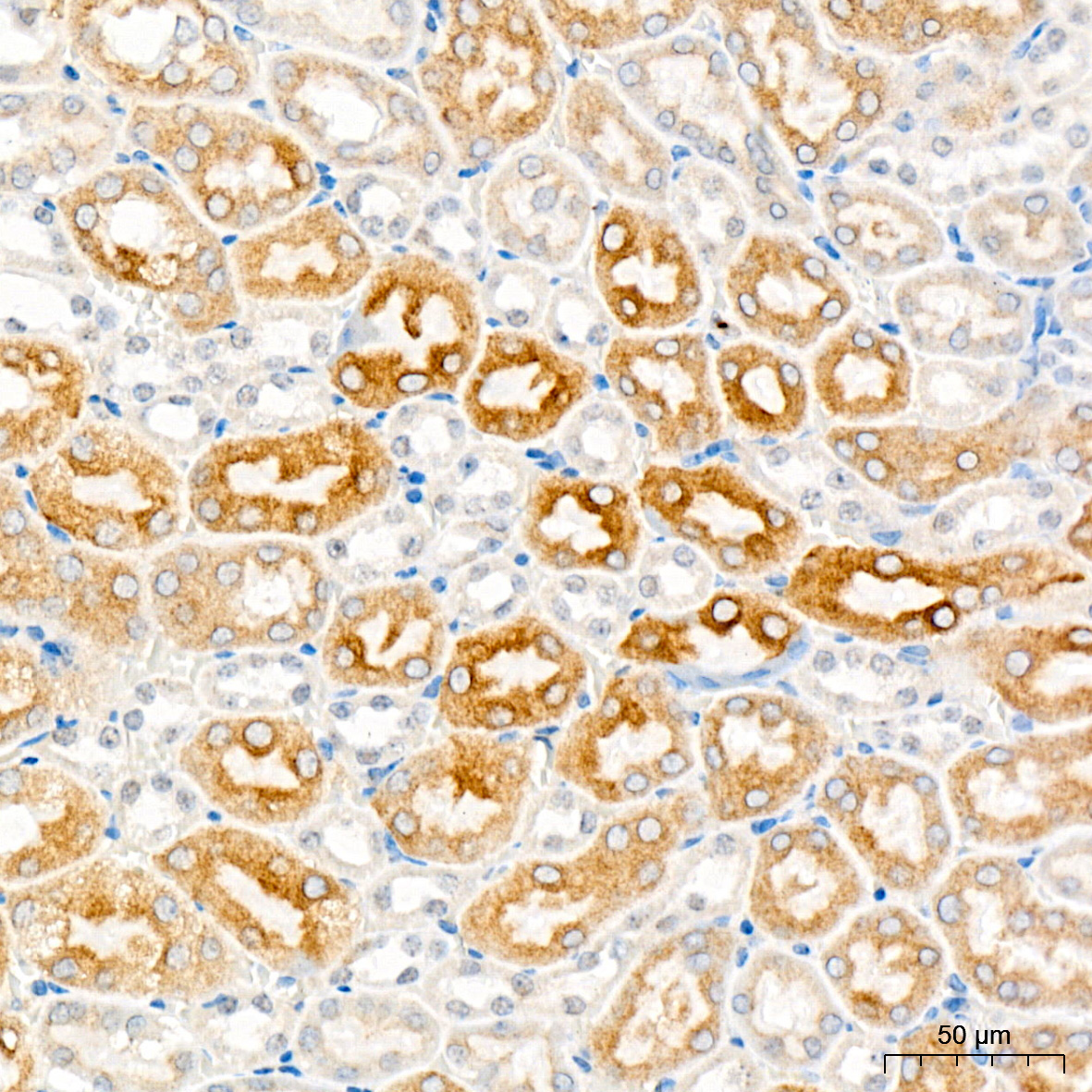 ENTPD5 Rabbit Monoclonal Antibody - Image 5
