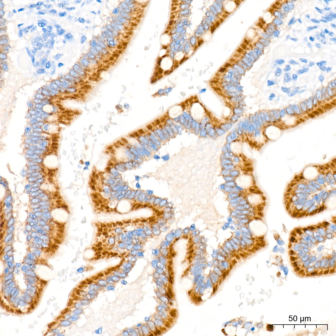ENTPD5 Rabbit Monoclonal Antibody - Image 6
