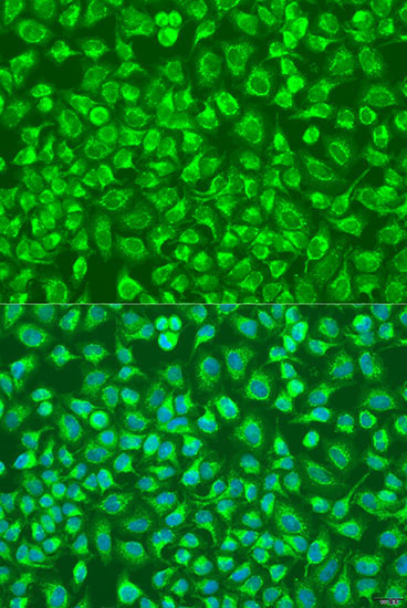ENTPD5 Rabbit Polyclonal Antibody
