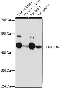 ENTPD6 Rabbit Polyclonal Antibody