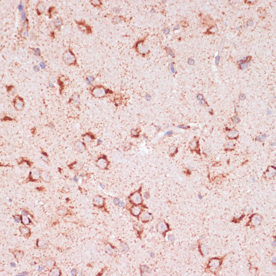 ENTPD6 Rabbit Polyclonal Antibody - Image 2