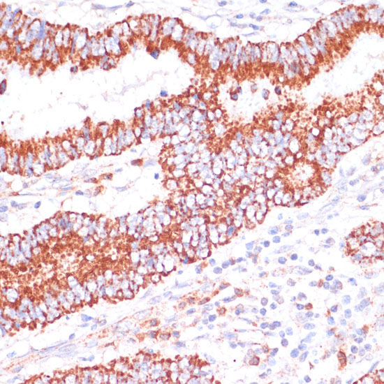 ENTPD6 Rabbit Polyclonal Antibody - Image 3