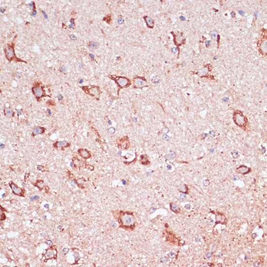 ENTPD6 Rabbit Polyclonal Antibody - Image 4