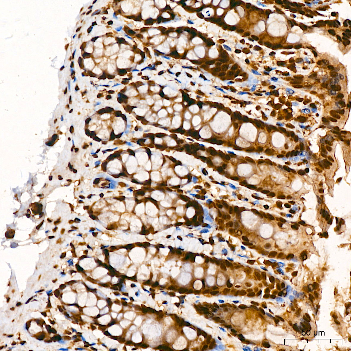 EP300 Rabbit Polyclonal Antibody
